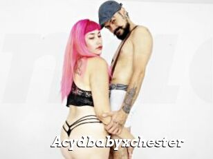 Acydbabyxchester